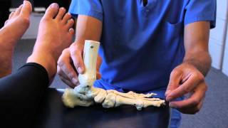 Spread Your Toes™ Series Flat Feet Conservative Care vs Conventional Care [upl. by Raval505]