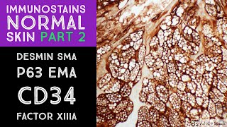 Immunohistochemistry in Normal Skin p63 EMA desmin SMA CD34 Factor XIIIa [upl. by Erdnuaed]