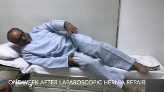 Recovery after Laparoscopic Hernia Repair [upl. by Mireielle]