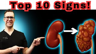 Top 10 Signs Your Kidneys are Begging For Help [upl. by Cheyne]