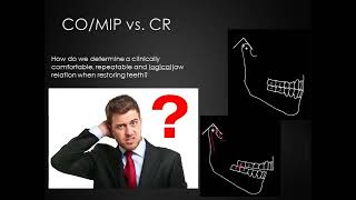 Occlusion for Prosthodontics [upl. by Kathe]