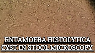 Entamoeba Histolytica Cyst under stool microscopy MLT WORLD [upl. by Nilac]