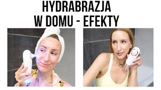 WODOROWE OCZYSZCZANIE TWARZY  WODNA MKRODERMABRAZJA od BEAUTIFLY  HYDRAPEEL đźŤ [upl. by Melisande]