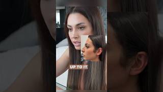 Leila Hormozi Nose Job amp Brow Lift leilahormozi hormozi browlift nosejob rhinoplasty brows [upl. by Yrahcaz]