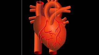 Attaque cardiaque infarctus du myocarde [upl. by Annaihr218]