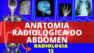 ANATOMIA RADIOLÓGICA DO ABDÔMEN  RAIOX DO ABDÔMEN  RADIOGRAFIA DO ABDÔMEN [upl. by Aerdnaz]