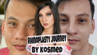 VLOG 39 MY RHINOPLASTY JOURNEY BY KOSMED rhinoplasty rhinoplastybeforeandafter [upl. by Bell]