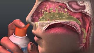 Can Saline Irrigation Help Nasal Allergies Animated Guide to Saline Nasal Irrigation [upl. by Eirallam]