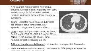 Detecting Vasculitis Before Its Too Late [upl. by Noitna]