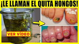 DILE ADIOS A LOS HONGOS EN LAS UÑAS CON UNAS GOTAS DE OREGANO [upl. by Inava483]