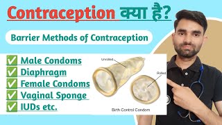 Barrier Methods of Contraception in Hindi  Contraception Lecture in Hindi [upl. by Amory]