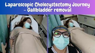 LAPAROSCOPIC CHOLECYSTECTOMY  Gallbladder removal surgery [upl. by Tiedeman]