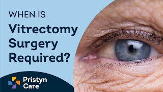 What is Vitrectomy Surgery  Pristyn Care [upl. by Erina]