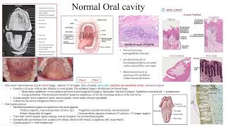 Pathology Made EasySystemic Pathology 15Head amp Neck Diseases2Oral cavity diseases1 [upl. by Attenhoj]