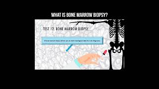 What is bone marrow biopsy biopsy bonemarrow [upl. by Tartan]