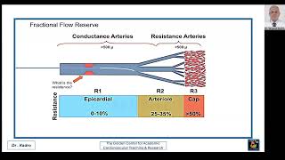 Ischemia Due to Coronary Microvascular Dysfunction CMVD Including INOCA amp ANOCA [upl. by Eixor]