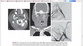 EMERGENCY RADIOLOGY REQUISITES [upl. by Ranzini209]