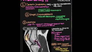 Radiographic Appearance Explain Everything Video [upl. by Map675]