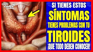 ¡Estos son los SÍNTOMAS DE UN PROBLEMA DE TIROIDES Pero muchas de mujeres los ignoran👉 [upl. by Ahsaei]