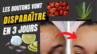 Comment éliminer les boutons du visage rapidement en 3 jours ≠4Astuces très efficaces [upl. by Adnocahs]