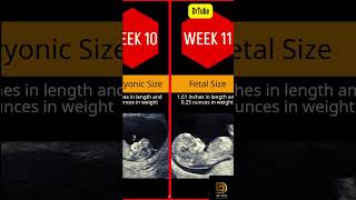 Pregnancy Week By Week  1  20 Weeks Fetal Developments  Ultrasound [upl. by Ihcalam]