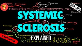 SCLERODERMA Systemic sclerosis Pathogenesis Diagnostic criteria Classification EULAR Treatment [upl. by Nivk794]