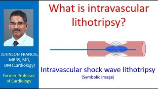 What is intravascular lithotripsy [upl. by Aonian27]