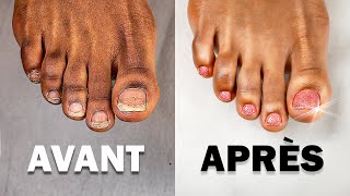 Tuto VERNIS SEMIPERMANENT Pieds  Comment faire une PÉDICURE Parfaite [upl. by Ennoid370]