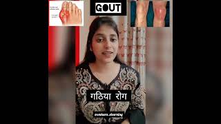 gout causepreventionगठिया के कारणनिवारणarthiritis goutgathiyagoutyuricacidytshortsyoutube [upl. by Dido]