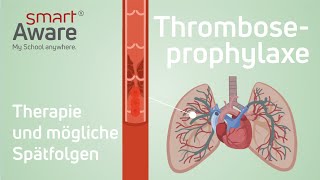 Thromboseprophylaxe Therapie und mögliche Spätfolgen  Fachfortbildungen in der Pflege  smartAware [upl. by Madi]