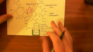 Vancomycin Resistant Enterococcus Part 3 [upl. by Haelhsa]