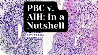 Primary Biliary Cholangitis v Autoimmune Hepatitis In a Nutshell pathagonia [upl. by Alviani]