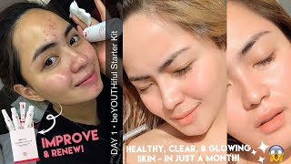 HOW I GOT RID OF MY PIMPLES  RYX SKINCERITY BEYOUTHIFUL STARTER KIT PERSONAL JOURNEY [upl. by Eckblad]