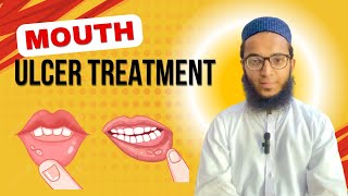 Mouth Ulcers Treatment  Fun Secrets  AsjadRaza FunSecrets [upl. by Neahs]