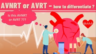 AVNRT VS AVRT  How to differentiate AVNRT from AVRT on ECG  definition ECG findings and examples [upl. by Lerner683]