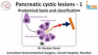 Pancreatic cystic neoplasms  Part 1  Anatomical basis and Classification [upl. by Towney]