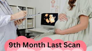 9th Month Pregnancy Ultrasound Last Scan Before Baby’s Arrival pregnancy pregnant dailyvlog [upl. by Nahgiem]