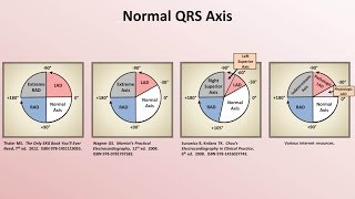 Intro to EKG Interpretation  Rate and Axis [upl. by Kirk635]