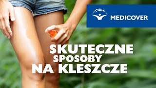 Kleszcz – skuteczne sposoby na kleszcze [upl. by Henka]