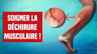 SOIGNER UNE DÉCHIRURE MUSCULAIRE  EXPLICATION ET TRAITEMENT [upl. by Atiloj]