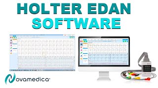 ✅Holter EDAN Software  Vistas General y Opciones [upl. by Vieva]