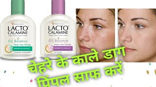 LACTO CALAMINE REVIEWLACTO CALMINE USESBest water based moisturizer for oily skin [upl. by Zicarelli]