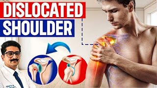 Dislocated Shoulder Causes Symptoms amp Treatment  Pain Free Recovery From Shoulder Dislocation [upl. by Elwin215]