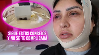 CÓMO SON LOS PRIMEROS 15 DIAS DESPUÉS DE UNA ABDOMINOPLASTIA Y LIPOESCULTURA TODOS LOS TIPS AQUÍ [upl. by Nolak628]