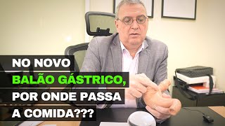 Novo BALÃO GÁSTRICO por onde passa a comida [upl. by Nerua]