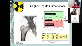 AULA DENSITOMETRIA ÓSSEA  PARTE 01 [upl. by Sang]