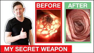 How To STOP Candida FAST [upl. by Arednaxela]