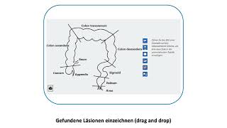 Gastroenterologen Koloskopie eingeben [upl. by Fording146]