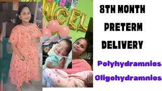 Part1 PRETERM DELIVERY polyhydramnios குறைமாத பிரசவம்பனிக்குட நீர் அதிகம் குறைவு subscribe [upl. by Birk]