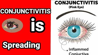 conjunctivitis is spreading all over india⚠️eye fluGOVIND ZOFIA [upl. by Ellezaj174]